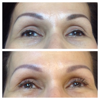 Lash Lift